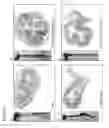 Fig. 12 - Targeted Delivery Platform for Delivery of Therapeutics