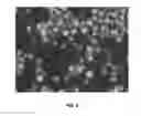 Fig. 05 - Compositions and associated methods for radioisotope-binding microparticles