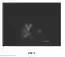 Fig. 07 - Compositions and associated methods for radioisotope-binding microparticles