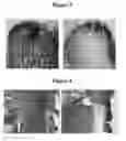 Fig. 03 - USE OF POLYMERIC MATERIAL TO REPAIR OSTEOCHONDRAL DEFECTS