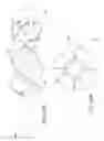 Fig. 28 - Catheter pump assembly including a stator