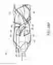 Fig. 30 - Catheter pump assembly including a stator