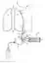 Fig. 01 - DEVICE AND METHOD TO FACILITATE PLEURODESIS FOR MANAGEMENT OF FLUID DRAINAGE