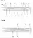Fig. 03 - Spring-driven drug delivery device