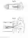 Fig. 12 - Smart valved holding chamber