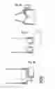 Fig. 28 - Smart valved holding chamber