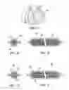 Fig. 17 - CONDENSATION REDUCTION AND MANAGEMENT SYSTEMS IN A GAS FLOW DELIVERY SYSTEM