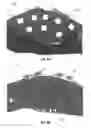 Fig. 07 - TETHERLESS WEARABLE THERMAL DEVICES AND METHODS OF USING THEM FOR TREATMENT OF SLEEPING AND NEUROLOGICAL DISORDERS
