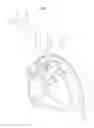 Fig. 08 - VESSEL ACCESS CATHETER
