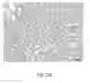 Fig. 28 - Ureteral and bladder catheters and methods of inducing negative pressure to increase renal perfusion