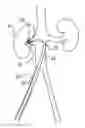 Fig. 01 - Curved catheter