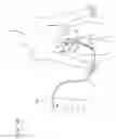 Fig. 06 - Curved catheter