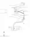 Fig. 07 - Curved catheter