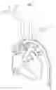 Fig. 08 - VESSEL ACCESS CATHETER