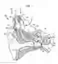 Fig. 02 - Implantable stimulating assembly arrangements