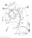 Fig. 04 - Implantable stimulating assembly arrangements