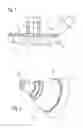 Fig. 02 - Method for manufacturing a rotationally symmetrical shaped article