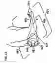 Fig. 16 - Elevated shaver