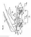 Fig. 32 - Elevated shaver