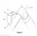 Fig. 05 - Carrier mounting