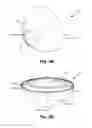 Fig. 04 - System and method for nose cone edge delamination repair