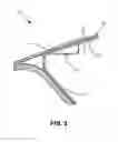 Fig. 07 - System and method for nose cone edge delamination repair