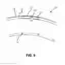 Fig. 09 - System and method for nose cone edge delamination repair