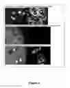 Fig. 05 - Mosquitocidal xenorhabdus, lipopeptide and methods
