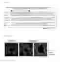 Fig. 08 - Method for identifying a compound useful with myosin regulatory light chain polypeptide antibody for treatment of an inflammatory disease