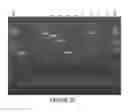 Fig. 35 - Genetically-modified cells comprising a modified human T cell receptor alpha constant region gene