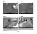 Fig. 07 - METHODS FOR MAINTAINING AND EXPANDING MESENCHYMAL STEM CELLS ON EXTRACELLULAR MATRIX COATED MICROCARRIERS