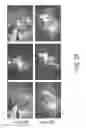 Fig. 06 - RNA interference suppression of neurodegenerative diseases and methods of use
