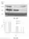 Fig. 45 - RNA interference suppression of neurodegenerative diseases and methods of use