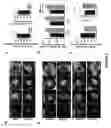 Fig. 02 - Use of a reverse-transcriptase inhibitor in the prevention and treatment of degenerative diseases