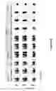 Fig. 140 - Altering Gene Expression in CART Cells and Uses Thereof