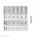 Fig. 92 - Altering Gene Expression in CART Cells and Uses Thereof