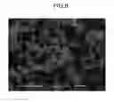Fig. 09 - METHOD OF PRODUCING SILICON-PLATED METAL SHEET