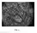 Fig. 06 - Nonwoven fabric comprising a high loft spunbond layer