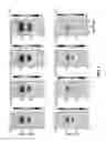 Fig. 09 - Rotating current excitation with array magnetic sensors nondestructive testing probe for tube inspection