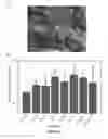 Fig. 16 - NOVEL METHODS AND DEVICES FOR HIGH-THROUGHPUT QUANTIFICATION, DETECTION AND TEMPORAL PROFILING OF CELLULAR SECRETIONS, AND COMPOSITIONS IDENTIFIED USING SAME