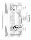 Fig. 35 - Identification of novel disease states using viscoelastic analysis in the presence of a thrombolytic agent