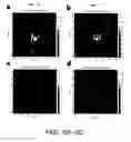 Fig. 06 - System and method for device tracking via magnetic resonance imaging with light-modulated magnetic susceptibility markers