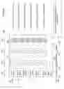 Fig. 04 - Systems and Methods Involving Single Vision and Multifocal Lenses for Inhibiting Myopia Progression