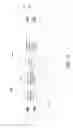Fig. 11 - Apparatus and method for processing audio signals