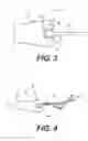 Fig. 03 - Method for determining vibratory contact stress at a blade attachment