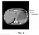 Fig. 05 - Picture archiving system with text-image linking based on text recognition