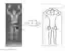 Fig. 01 - Body scanner with automated target recognition