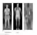 Fig. 03 - Body scanner with automated target recognition