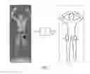 Fig. 04 - Body scanner with automated target recognition