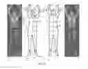 Fig. 06 - Body scanner with automated target recognition